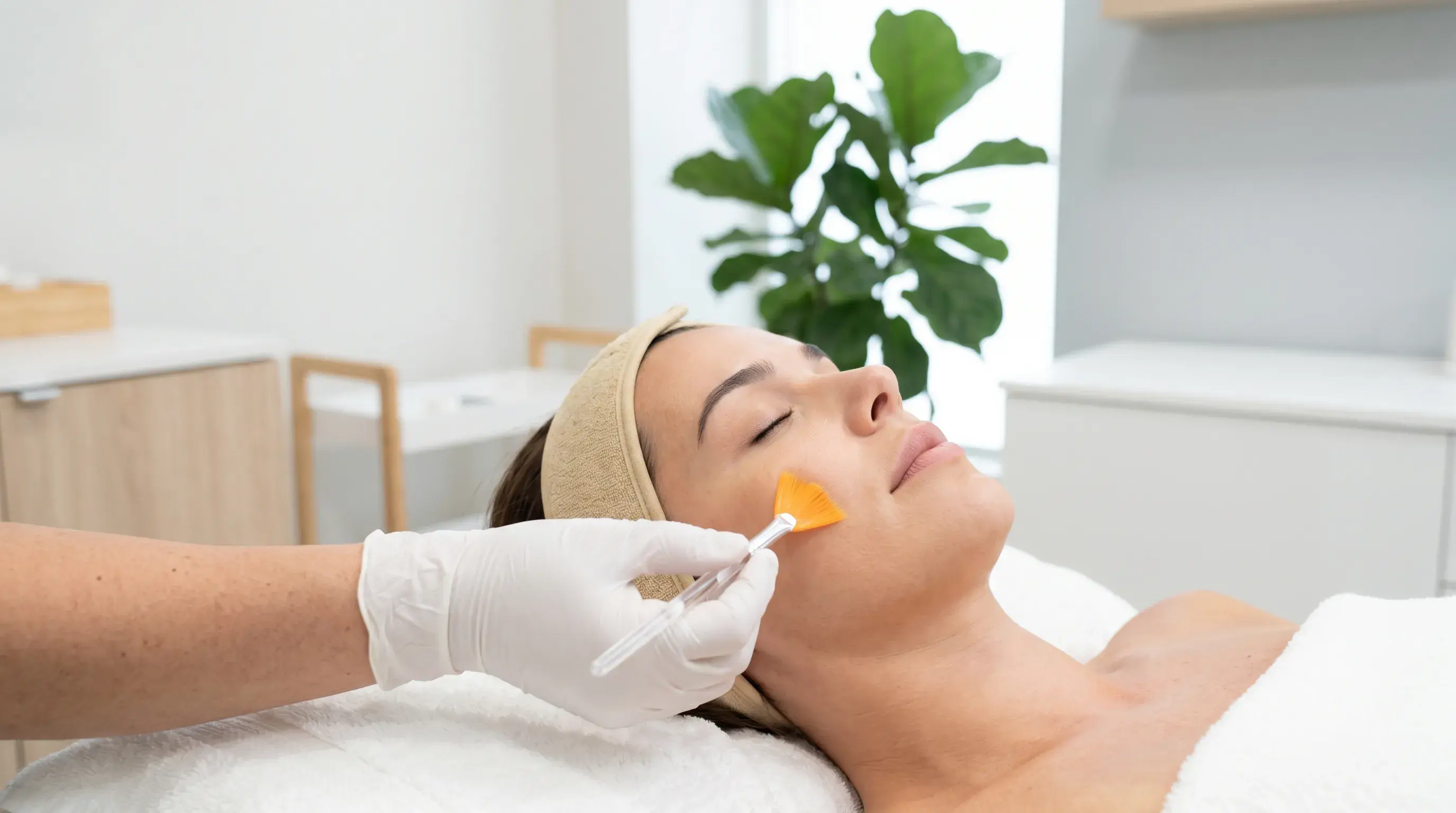 Chemical Peel
